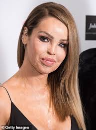 Katie Piper